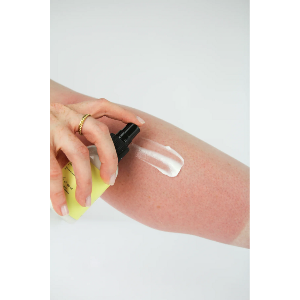 Aftersun lotion